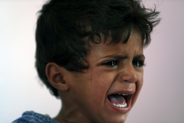 Millions of children are casualties of years-long war in Yemen