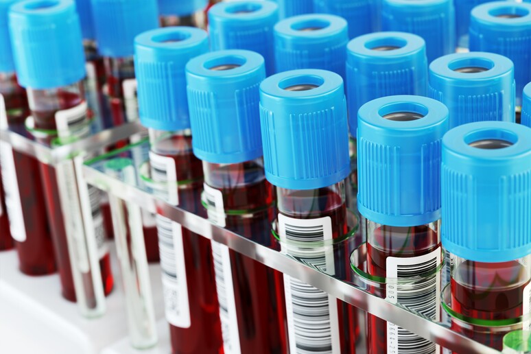 Ottenuti litri di sangue artificiale con cellule staminali - RIPRODUZIONE RISERVATA