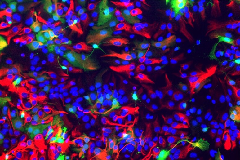 Cellule staminali del cervello (fonte: Laboratorio di Sviluppo Corticale/SISSA) - RIPRODUZIONE RISERVATA