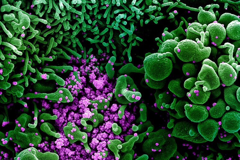L 'infezione di una cellula da parte del SarsCoV2, vista al microscopio elettronico (fonte: NIAID) - RIPRODUZIONE RISERVATA