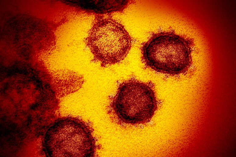 Dettaglio delle particelle del coronavirus SarsCov2 ottenute dal Niaid. Evidenti le protuberanze che danno l 'impressione di una corona (fonte: NIAID-RML) - RIPRODUZIONE RISERVATA