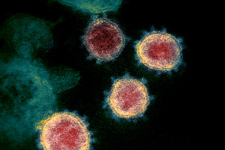 Il coronavirus visto al microscopio elettronico (fonte: NIAID-RML) - RIPRODUZIONE RISERVATA