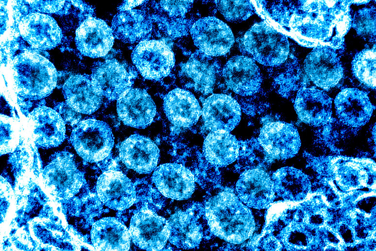 Particelle di coronavirus viste al microscopio eletttronico (fonte: NIAID) - RIPRODUZIONE RISERVATA