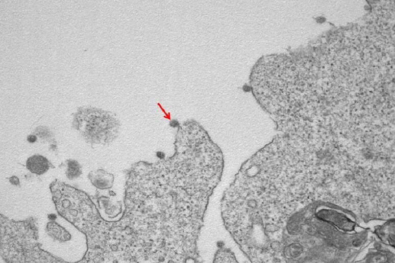 La freccia indica una particella di coronavirus (fonte: Laboratorio di Anatomia patologica del Dipartimento di Scienze biomediche dell 'Università Statale di MIlano) - RIPRODUZIONE RISERVATA
