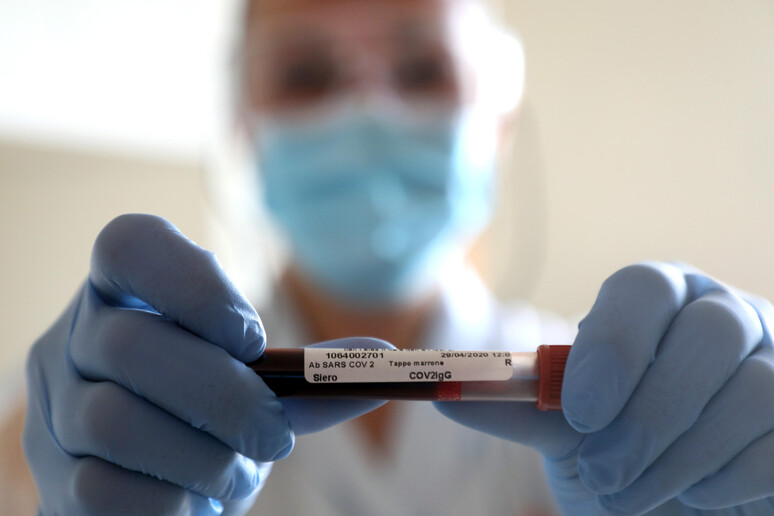 Coronavirus: tamponi e test sierologici - RIPRODUZIONE RISERVATA