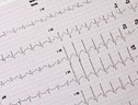 Elettrocardiogramma (ANSA)