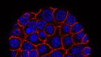 Cellule tumorali del pancreas (fonte: Min Yu,USC Norris Comprehensive Cancer Center) (ANSA)