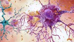 Alzheimer e Parkinson potrebbero avere un'origine comune (fonte: National Institute on Aging, NIH) (ANSA)