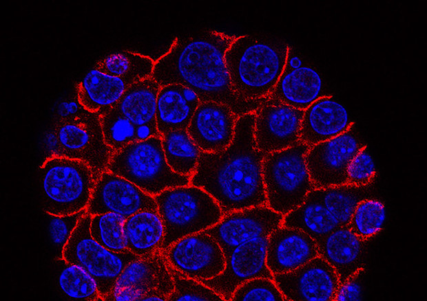 Cellule tumorali del pancreas (fonte: Min Yu,USC Norris Comprehensive Cancer Center) © Ansa