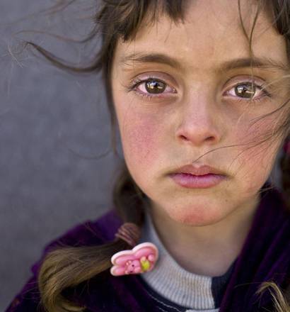 The winning photograph 'UNICEF Photo of  the Year 2017' by Muhammed Muheisen from AP of Syrian refugee girl Zahra Mahmoud, 5.