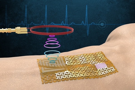 La pelle elettronica wireless, senza chip per il Bluetooth né batterie (fonte: MIT) © Ansa