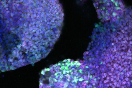 I ricercatori hanno riprogrammato i fibroblasti in cellule simili alle progenitrici degli arti negli embrioni (fonte: Yuji Atsuta)