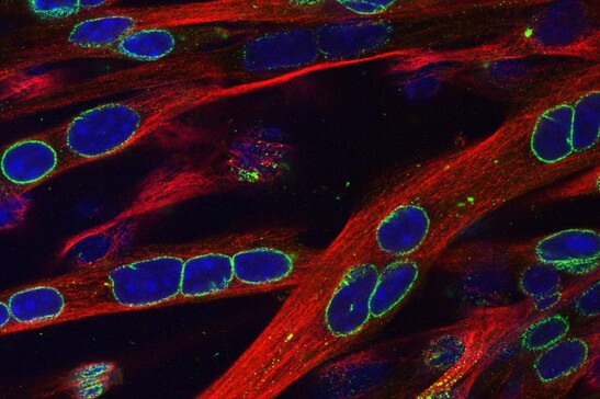 Una coltura di cellule dei muscoli (fonte: Evelyn Ralston, Ph.D., of the NIAMS Light Imaging Section via Flickr)