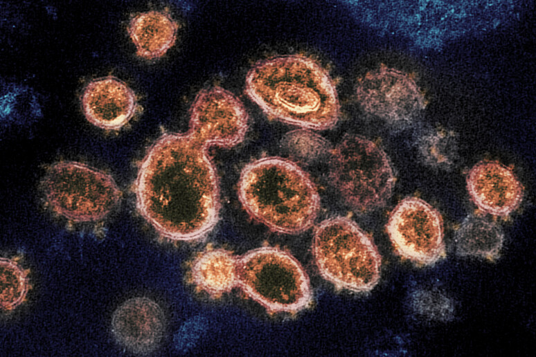 Il coronavirus SarsCoV2 (fonte: NIAID-RML) - RIPRODUZIONE RISERVATA