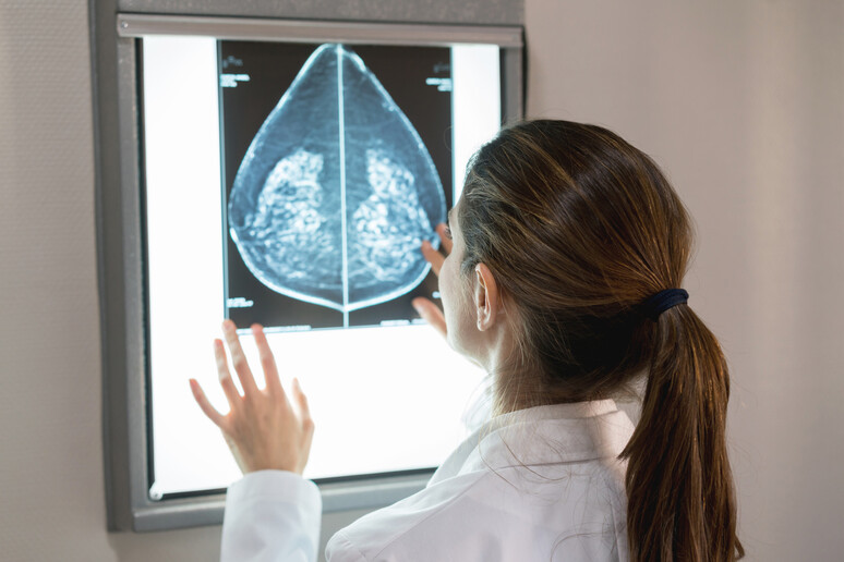 L’ecografia aumentata dall’IA per individuare il cancro al seno - RIPRODUZIONE RISERVATA