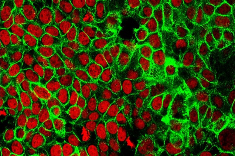 Cellule del tumore del colon (fonte: NCI Center for Cancer Research) - RIPRODUZIONE RISERVATA