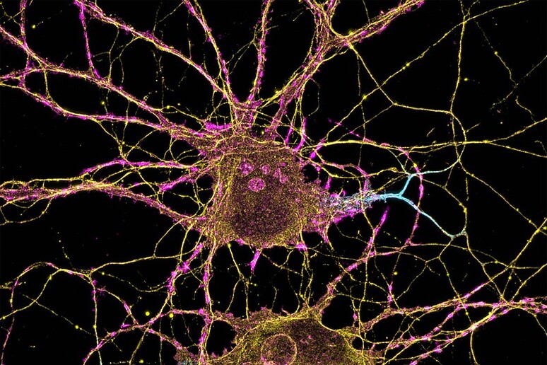 Neuroni (fonte: Leterrier, NeuroCyto Lab, INP, Marsiglia, Francia) - RIPRODUZIONE RISERVATA