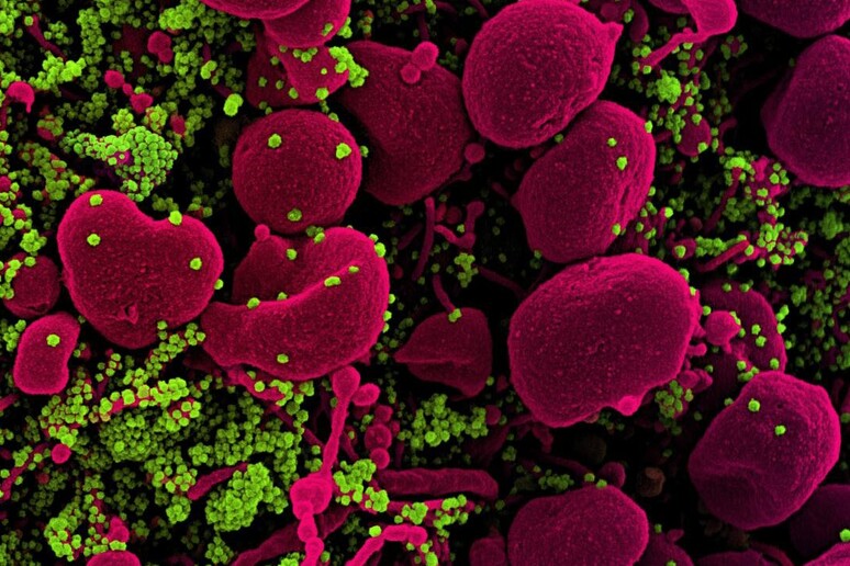 In verde particelle di virus SarsCoV2 sulla superficie di una cellula (fonte: NIAID) - RIPRODUZIONE RISERVATA