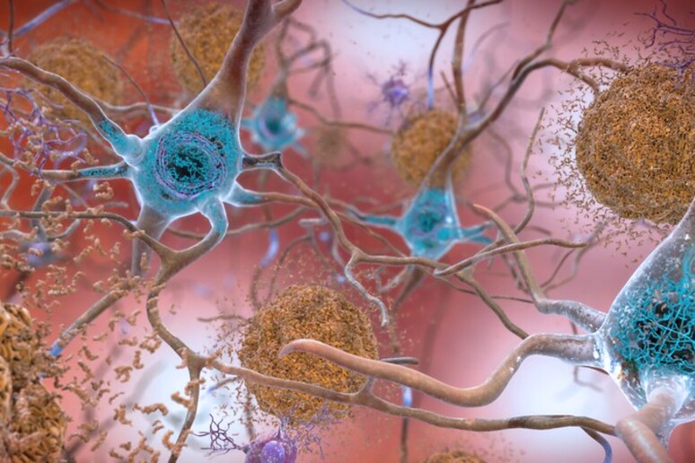 Individuate sei nuove varianti geniche legate all’Alzheimer (fonte: National Institute on Aging, NIH) - RIPRODUZIONE RISERVATA