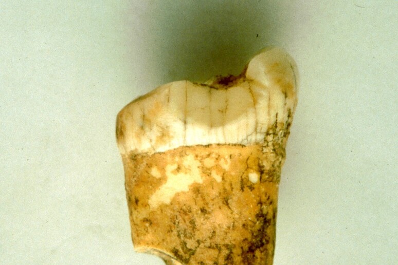 l molare proveniente dal sito di Gabasa, in Spagna, utilizzato per lo studio. (Fonte: Lourdes Montes) - RIPRODUZIONE RISERVATA